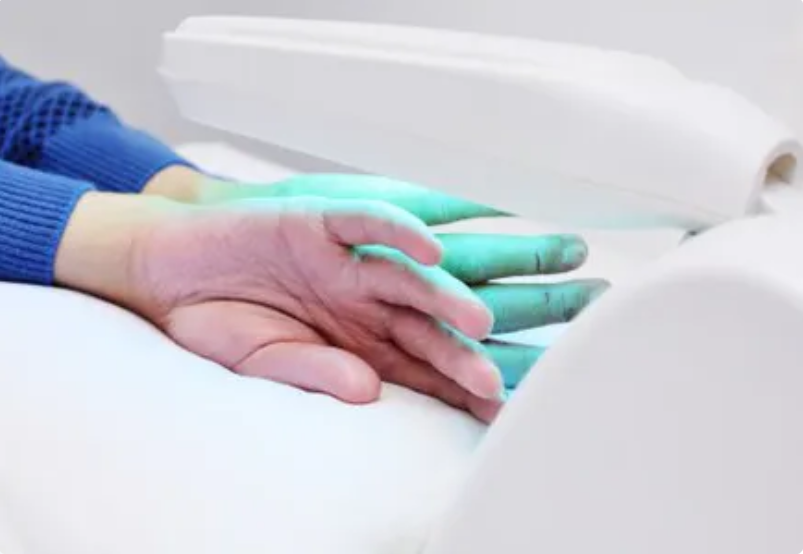 Revolutionizing Psoriasis Treatment with Phototherapy