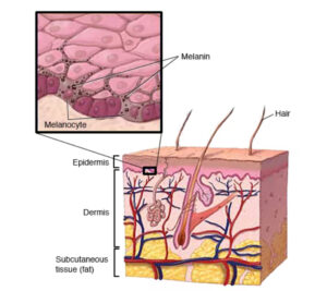 Illustration of melanocytes, affected by vitiligo