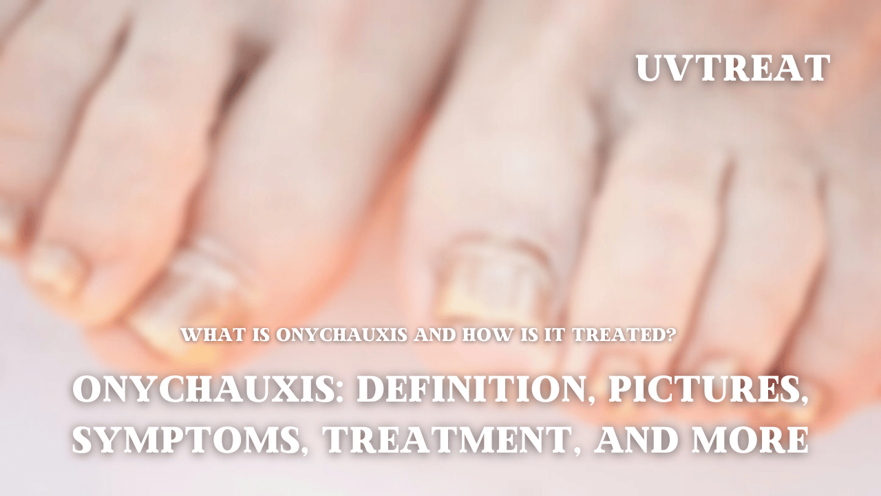 Onychauxis: Definition, Pictures, Symptoms, Treatment, and More