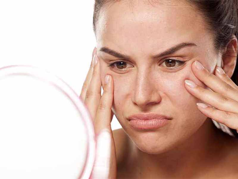 Eczema on Face: Causes, Symptoms, and Effective Treatments