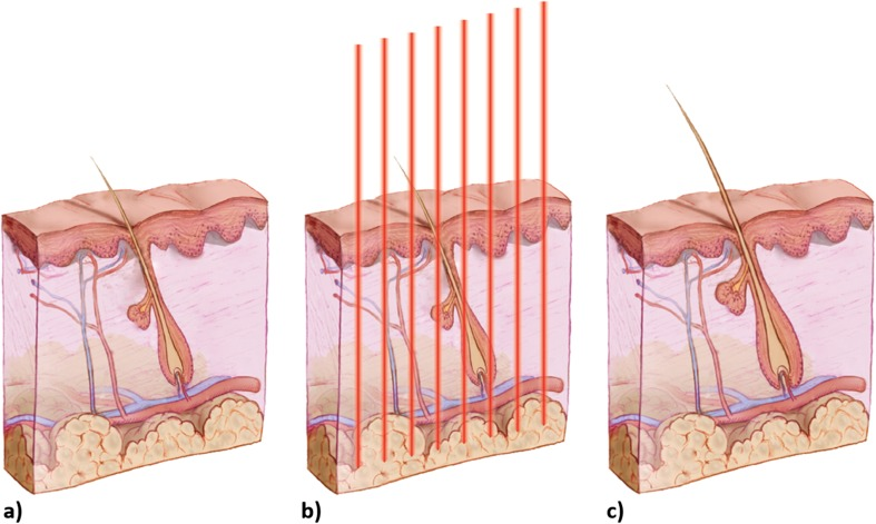 How Red Light Therapy Actually Works on Hair Follicles